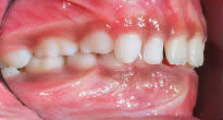 Closeup Teeth